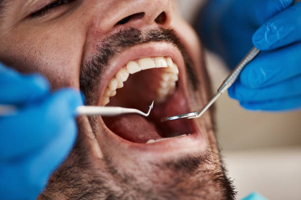 TMJ/TMD Treatment in Yardville, NJ